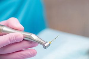 A dental tool used for root canals held by a dentist